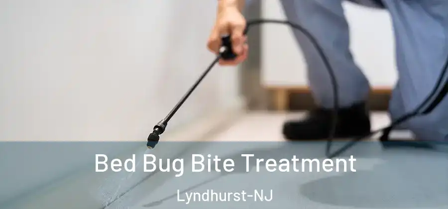  Bed Bug Bite Treatment Lyndhurst-NJ
